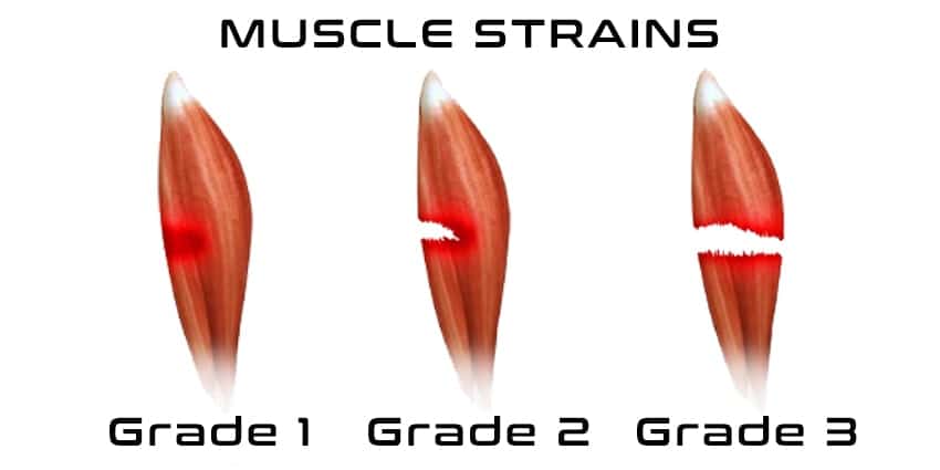 Image result for strain