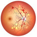 Stargardt Disease