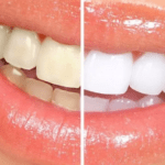 Cosmetic Dentistry