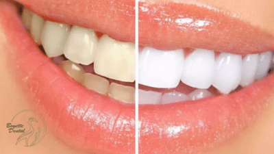 Cosmetic Dentistry