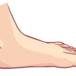 Flat Foot Home Remedies and Exercises
