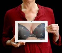 Causes of small breast size