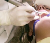 Endodontics Procedures